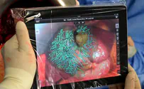 iPad-хирургия – новое слово в медицине  